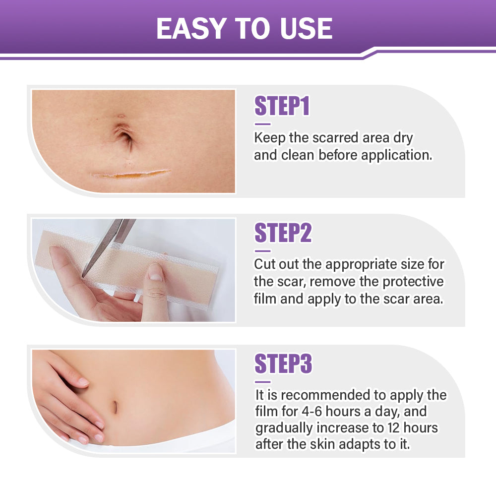ScarSilk™ Silicone Scar Reduction Strips™