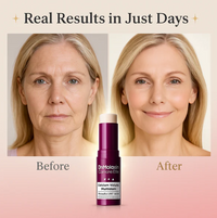 Erase Wrinkles & Dark Spots - Look 10 Years Younger in just weeks