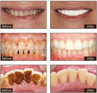 Niacinamide Whitening Toothpaste - Whiter Teeth, Fresh Breath