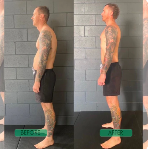 Posture Perfect Shoulder Brace™