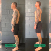 Posture Perfect Shoulder Brace™