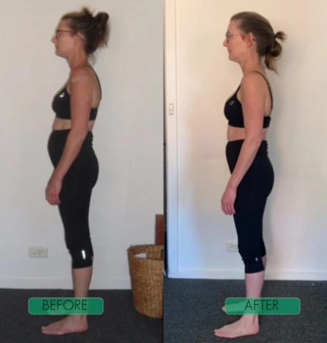 Posture Perfect Shoulder Brace™