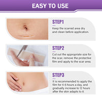 ScarSilk™ Silicone Scar Reduction Strips™