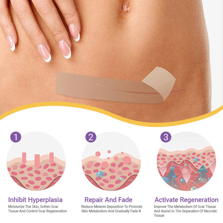 ScarSilk™ Silicone Scar Reduction Strips™