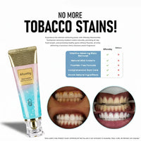 Niacinamide Whitening Toothpaste - Whiter Teeth, Fresh Breath